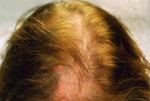 Female Hair example 2 before